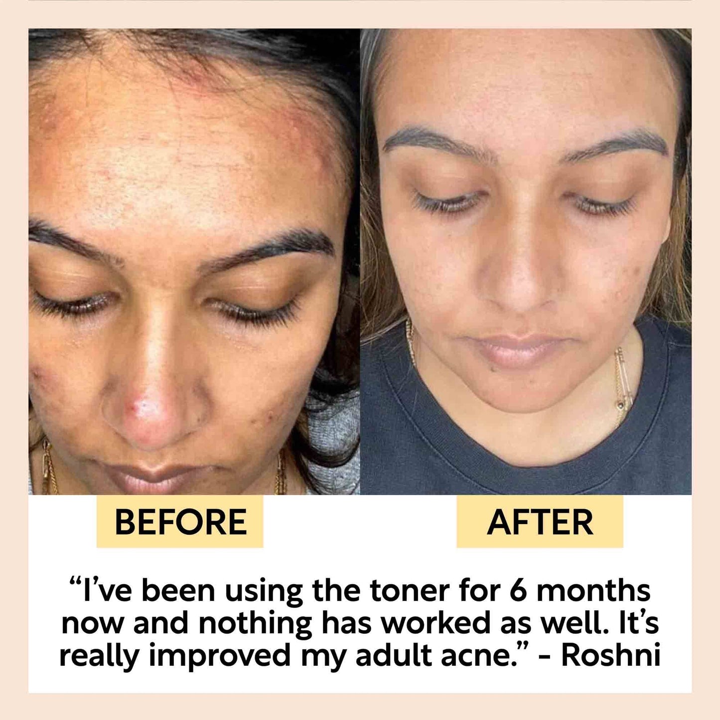 Vegan Face Toner with Hyaluronic Acid for Summer - Beach Travel Size